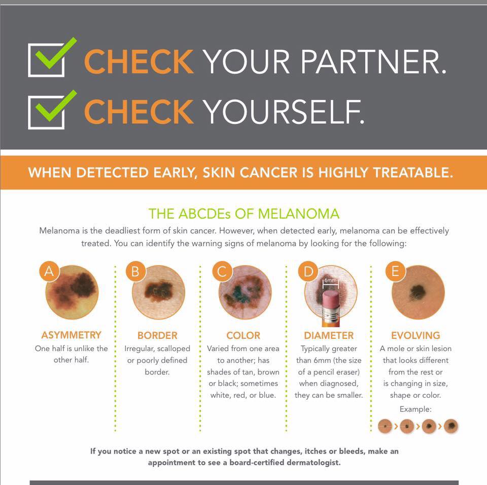 May Melanoma Month, Check Self, Partner for Skin Cancer